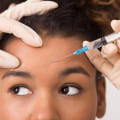 What are the downsides of botox in the forehead?