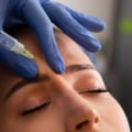 What can make botox less effective?