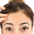 What is a good age for forehead botox?