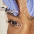 Should you get botox or juvederm first?