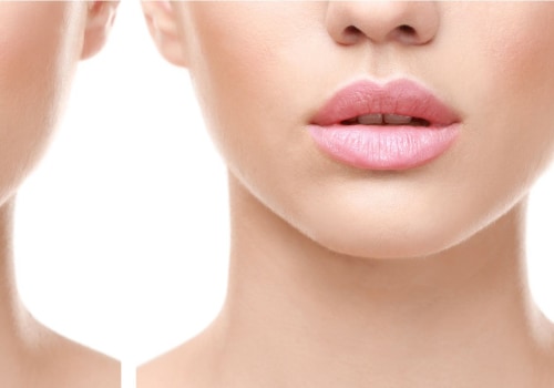 Is lip filler better than botox?