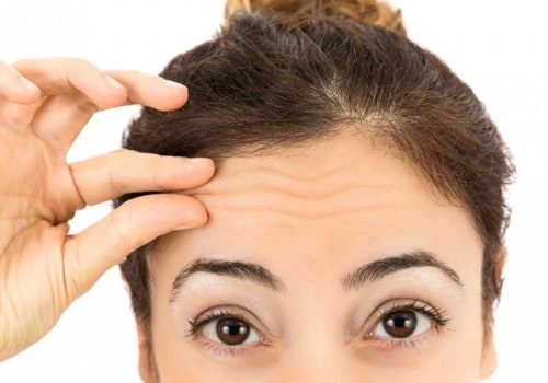 What is a good age for forehead botox?