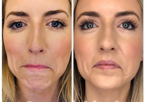 Is botox natural or man made?