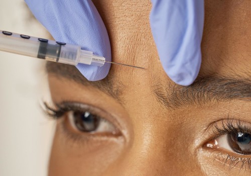 Should you get botox or juvederm first?