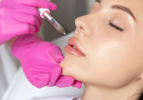 What are the downsides of botox lip flip?